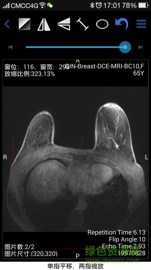 医影在线客户端下载